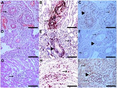 Porcine circovirus type 3: immunohistochemical detection in lesions of naturally affected piglets